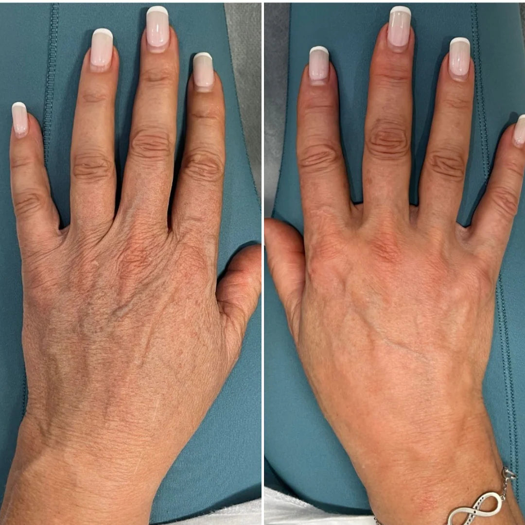 Crema de manos con Retinol